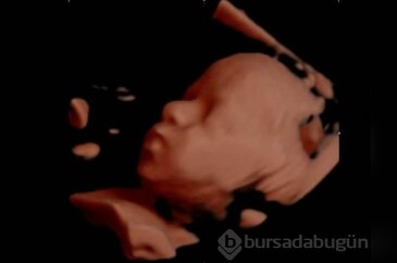 Bebeğin anne karnındaki fotoromanı