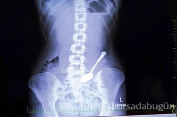 Dünyanın en tuhaf röntgen filmleri