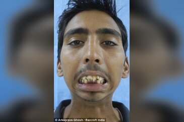 8 sene sonra ilk defa ağzını açtı