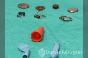Çocukların nefes borusundan bu cisimler çıktı!