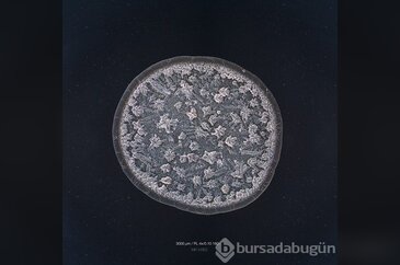 Gözyaşındaki sanat mikroskobik fotoğraflara yansıdı