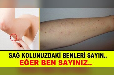 Sağ kolunuzdaki benleri sayın! eğer ben sayınız...