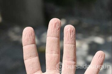 Parmakların suda buruşmasının gerçek nedeni