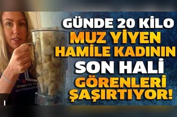 Günde 20 kilo muz yiyen kadın görenleri şoke ediyor!