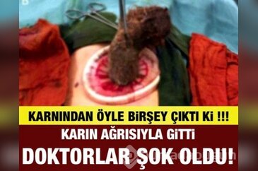 Karın ağrısıyla gitti... Doktorlar şok oldu!
