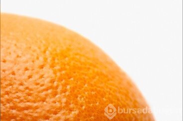 Selülit düşmanı anti diyet