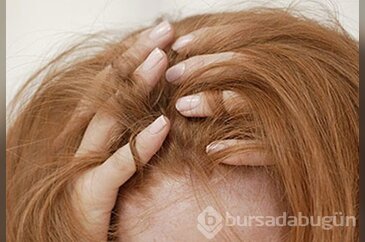 Saç koparma hastalığı (Trikotillomani)
