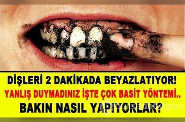 Bu yöntemle dişlerini 2 dakikada beyazlatıyorlar