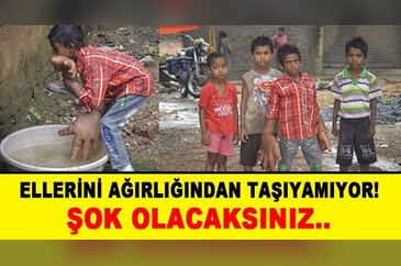 Ellerini ağırlığından taşıyamıyor!
