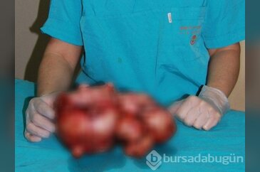 Çocuğum olmuyor diye doktora gitti... Bakın ne çıktı!