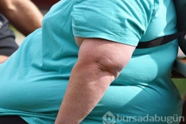 Yüzyılın salgını obezite: Türkiye Avrupa'da ...