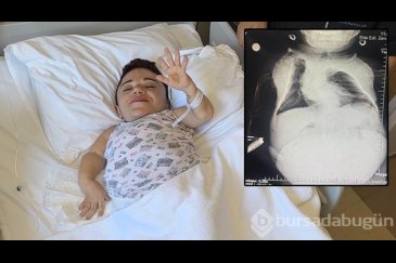 24 kilo ağırlığındaki Nurdan'ın yumurtalıkla...