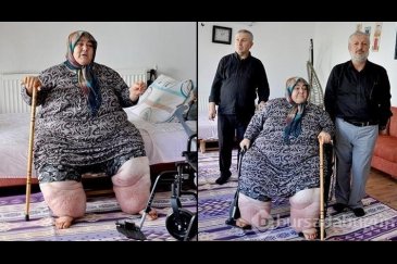 3 yıldır evden çıkamayan fil hastası kadının...