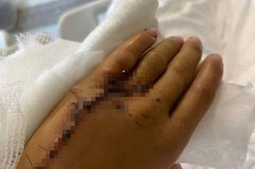 Eşinin darbettiği Iryna: Duruşmada yüz yüze ...