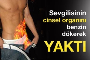SEVGİLİSİNİN CİNSEL ORGANINI YAKTI