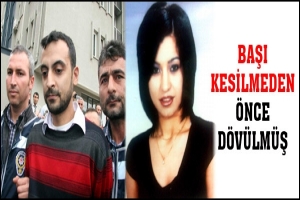 VAHŞETİNİN MAĞDURU &Ouml;LMEDEN &Ouml;NCE D&Ouml;V&Uuml;LM&Uuml;Ş