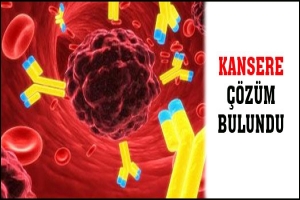 KANSERE &Ccedil;&Ouml;Z&Uuml;M BULUNDU
