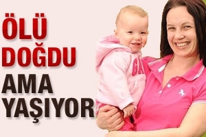 &Ouml;L&Uuml; DOĞDU AMA YAŞIYOR