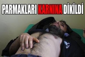 PARMAKLARI KARNINA DİKİLDİ