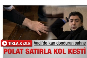 POLAT SATIRLA KOL KESTİ
