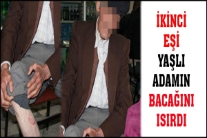 İKİNCİ EŞİ YAŞLI ADAMIN BACAĞINI ISIRDI