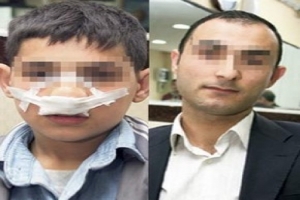 PALYA&Ccedil;OYA G&Uuml;LEN &Ouml;ĞRENCİNİN BURNUNU &Ccedil;ATLATTI