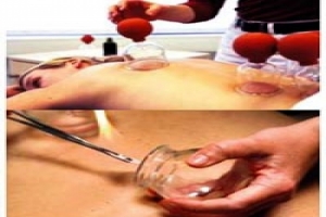 BARDAK &Ccedil;EKME TERAPİSİ YILDIZLARIN İLK TERCİHİ