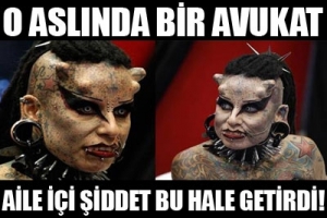 AİLE İ&Ccedil;İ ŞİDDET BU HALE GETİRDİ
