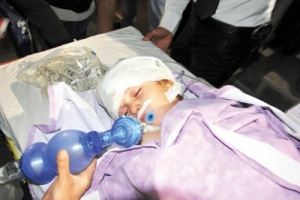 2 YAŞINDAKİ ELİF'İN BAŞINA GAZ BOMBASI