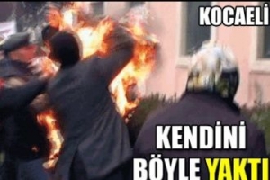 BASIN A&Ccedil;IKLAMASINDA KENDİNİ YAKTI