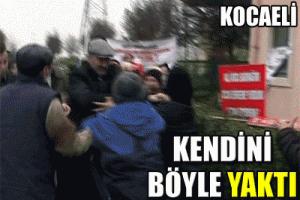 BASIN A&Ccedil;IKLAMASINDA KENDİNİ YAKTI