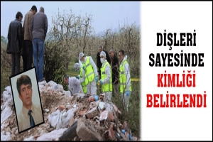 DİŞLERİ SAYESİNDE KİMLİĞİ BELİRLENDİ