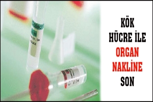 K&Ouml;K H&Uuml;CRE İLE ORGAN NAKLİNE SON