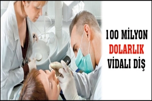 100 MİLYON DOLARLIK VİDALI DİŞ