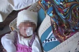 Bu bebek alev alan beşikten sağ &ccedil;ıktı