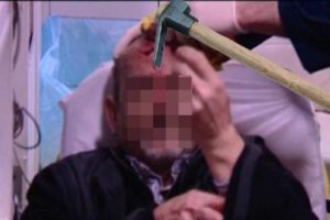 6. Kattan d&uuml;şen keser kafasını yardı
