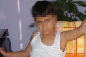 S&uuml;nnette fazla kesildi, kesilen yere ek par&ccedil;a dikildi!