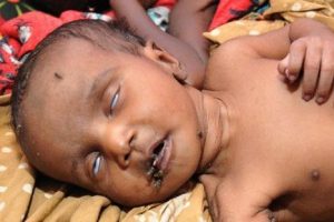 Somali'de Başbakan'ın şahit olduğu dram
