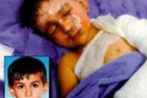 PKK'nın yaktığı k&uuml;rt &ccedil;ocuk bu hale geldi