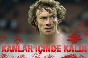 Lugano kanlar i&ccedil;inde kaldı