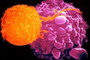 AIDS'le kanser tedavisi