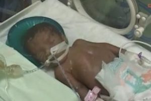PKK onu anne karnında &ouml;ks&uuml;z bıraktı