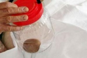 Mesanesinden 105 gr'lık taş &ccedil;ıktı!