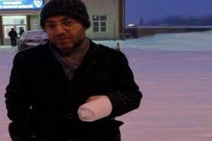 Doktorun parmaklarını kırdılar