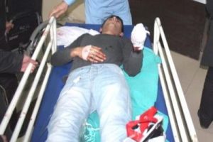 Polise atacağı bomba elinde patladı
