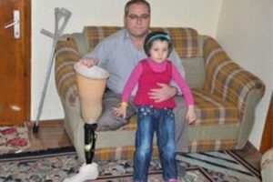 Devlet protez bacağı geri istiyor!