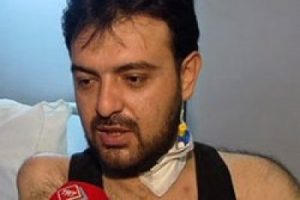 Kol ve bacak naklinde şok iddia