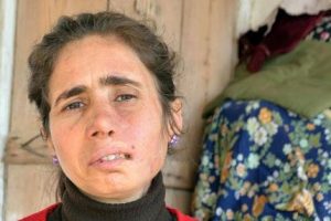4 yılda 30 ameliyat ge&ccedil;irdi