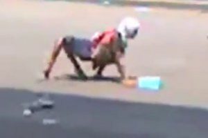 Milyonda bir g&ouml;r&uuml;len hastalık