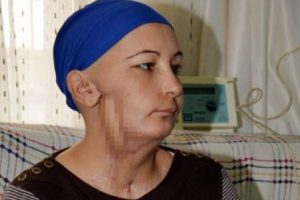 &Ccedil;ene nakli i&ccedil;in &ouml;l&uuml;me razı!